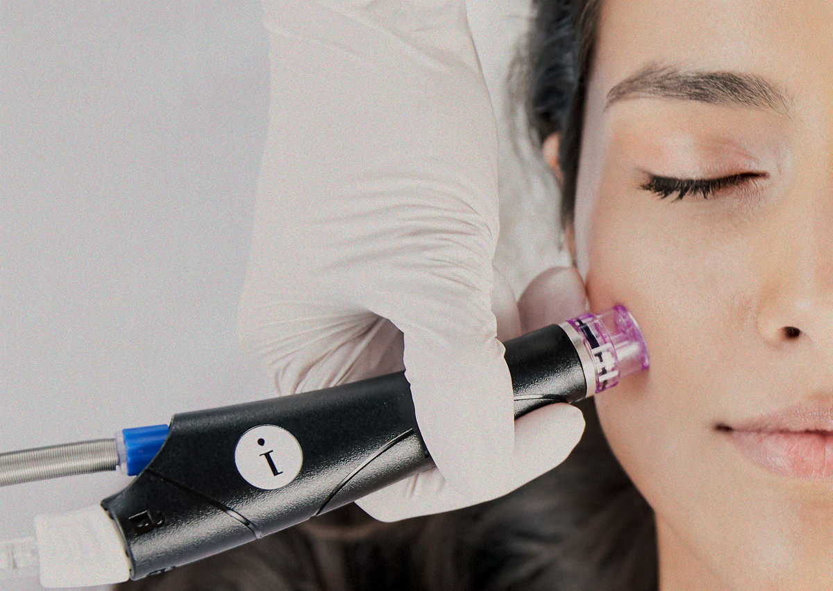 Hydrafacial treatment